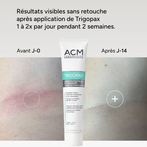 ACM Trigopax Soin Protecteur & Apaisant 40ml – photo 2
