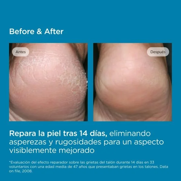 ISDIN Ureadin Podos Gel-Huile Hydratant Pieds 75ml – photo 2